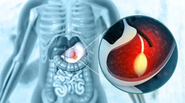 Endoscopy Questions Patients Ask Most Often
